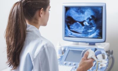 ultrasound tech salary